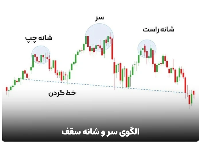  الگوی سر و شانه سقف